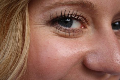 Hyalüronik Asit Nedir? Faydaları Nelerdir?